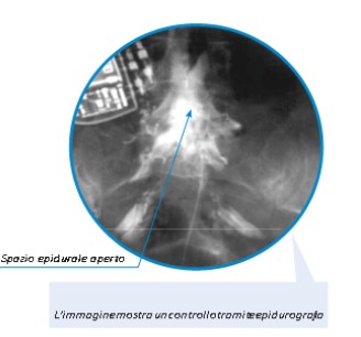 EPI-SENSE